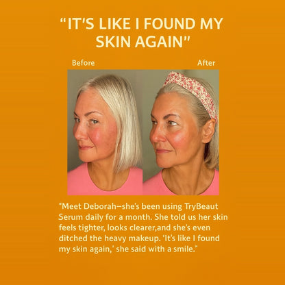 Turmeric + Hyaluronic Acid: Brightening Serum for Soft, Even Skin